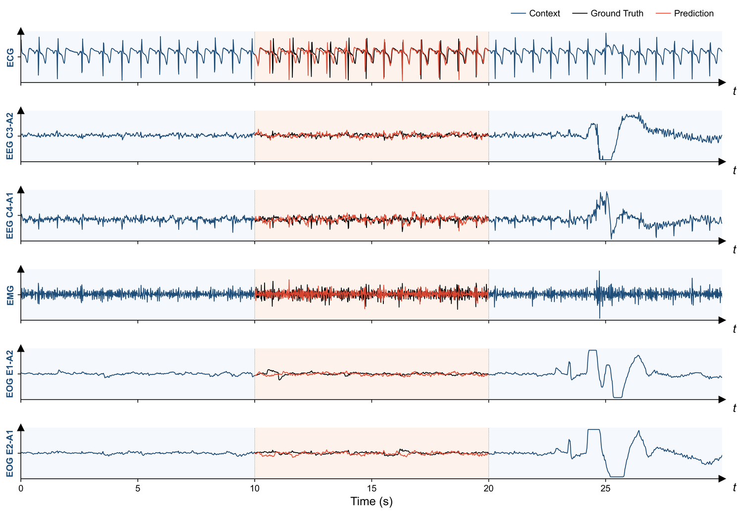Sleep-signal imputation example