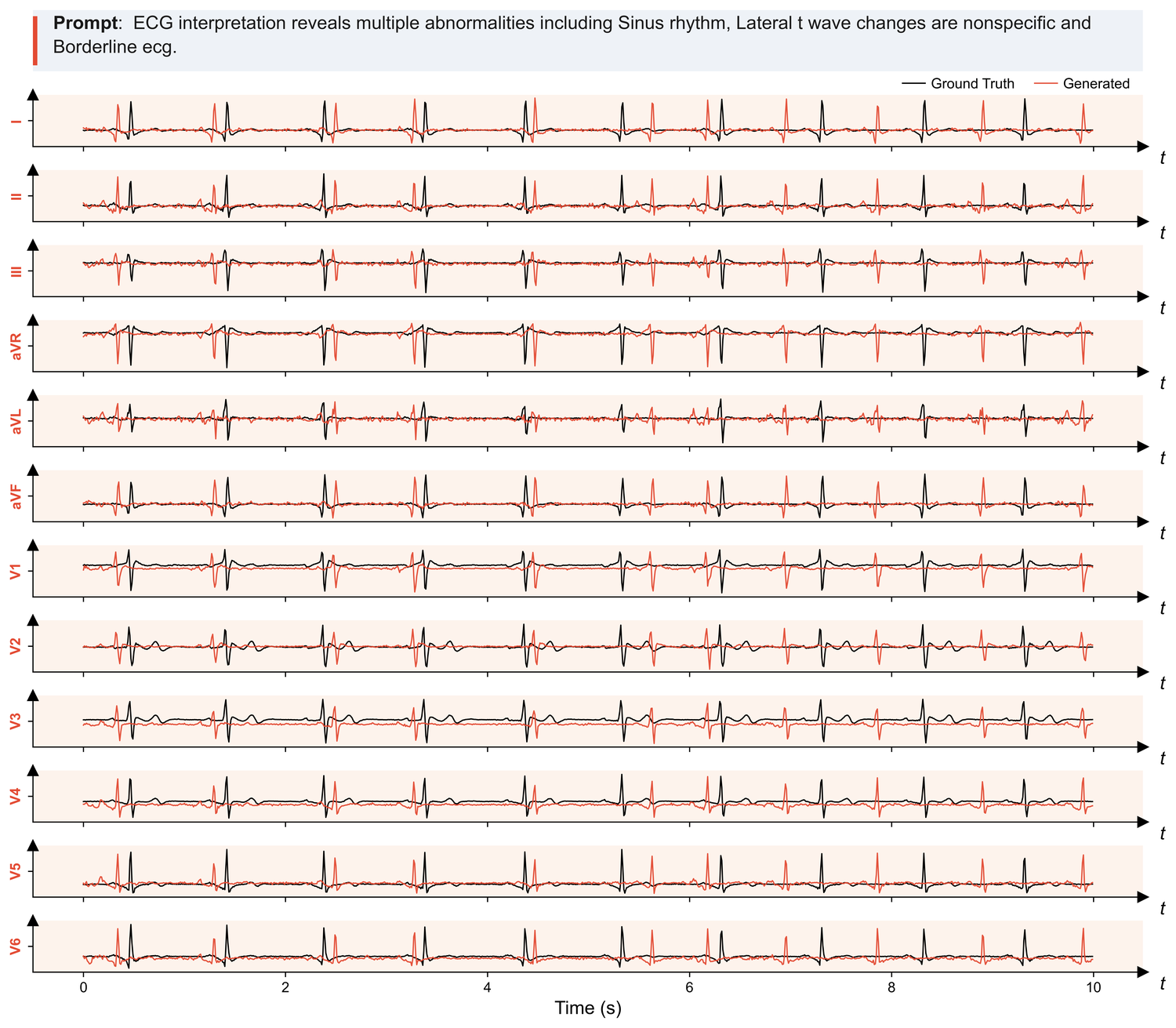 Text-to-ECG generation example